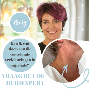 Pigmentvlekken in je hals