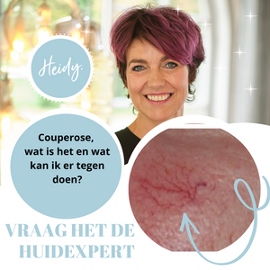COUPEROSE, WAT IS HET EN WAT KAN JE ER AAN DOEN?